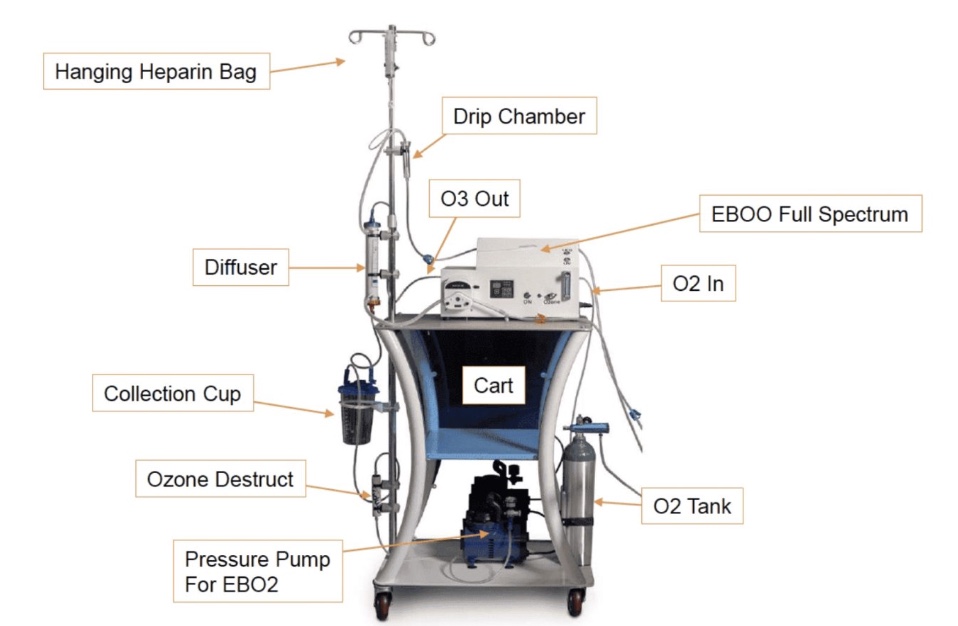 EBOO machine